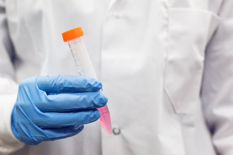 Lab Testing Basics: 3 Things All Importers Should Know